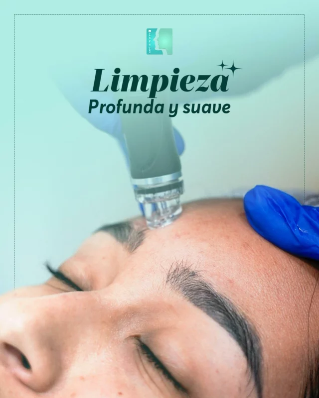 Limpieza profunda💖
Sentirte bien empieza por cuidarte.

Nuestra limpieza facial te da esa sensación de frescura y ligereza que tu piel y tu alma estaban esperando.

Suave. Profunda. Tuya.

📍 CAPMED | Santiago de los Caballeros
☎️ (809) 226-3616 - (829) 977-3616

#PielRadiante #BienestarInterior #CuidadoPersonal #Rejuvenecimiento #Capmed